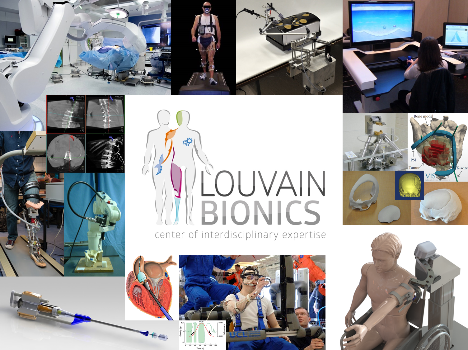 Belgique : jambes bioniques pour amputés transfémoraux